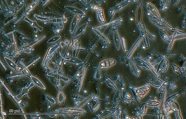 Live-diatoms-of-diatomaceous-earth-wildmoz.com